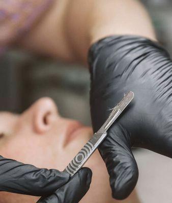 Dermaplane; dead skin cells and Vellus hair (peach fuzz)