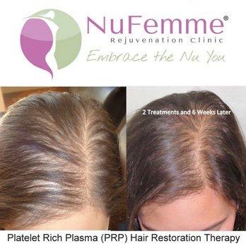 NuFemme Rejuvenation Clinic