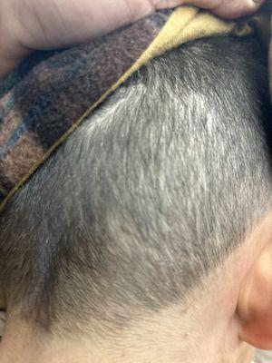 My son is now cured.