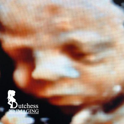 Dutchess 3D Imaging