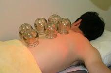 Cupping for Detoxification