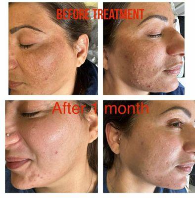 Esta imagen es un antes y un después lo que se realizó nuestra paciente y sus resultados