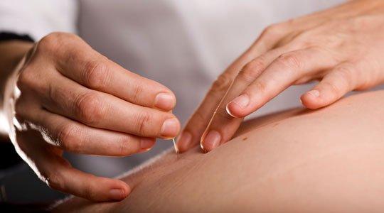 Needles with a Healing Touch