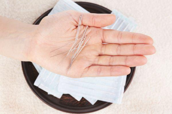 Jenna Martin Acupuncture - Laguna Hills