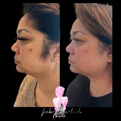 Reveal your radiance! Fab Ooh Lash transforms your skin for that flawless glow. #SkinRevival #FabOohLash