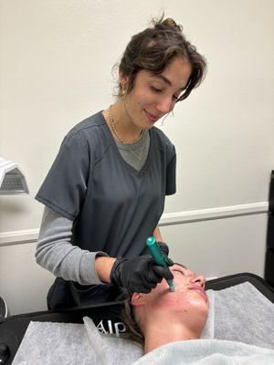 Dr. M treating a patient with Facial Microneedling.