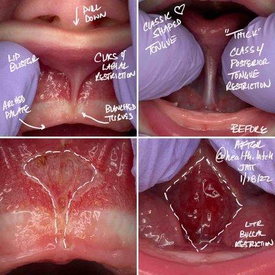 health:latch