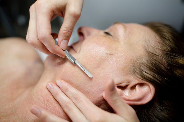 Dermaplaning Facial. New way of microdermabrasion.