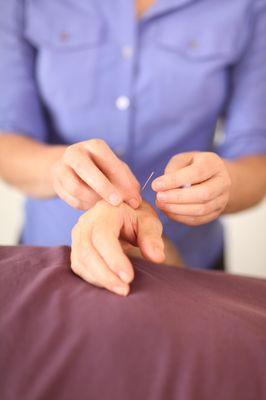 Acupuncture: simple, painless, and effective for some many complaints. Try it out