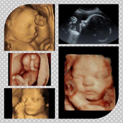 3D/4D/5D-HD images