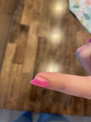 Poor filing- filed off half the width of my nail