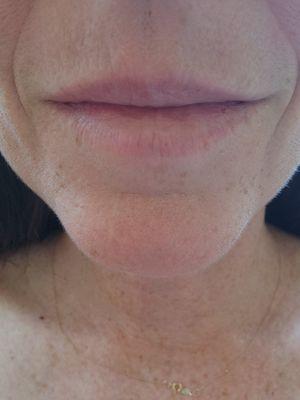 Medical Massage by Samantha