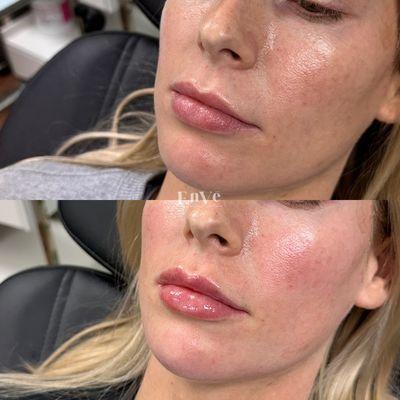 Enve California Aesthetics