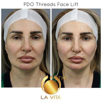 La Vita Laser & Aesthetics