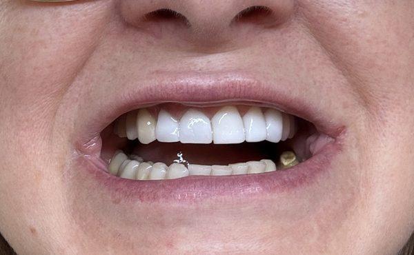 Richmond Dental Care