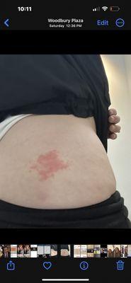 Walk-in Dermatology- Plainview