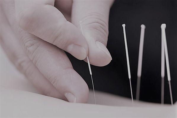 Upright Acupuncture and Shiatsu