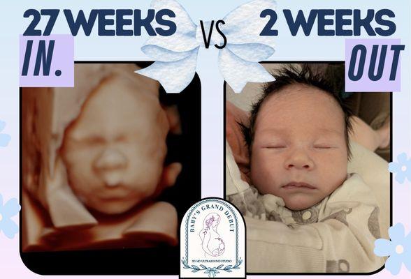 Baby’s Grand Debut