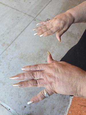 We've paid several times to have her nails clipped. Hasn't been done. They're too long for an alzheimers patient.