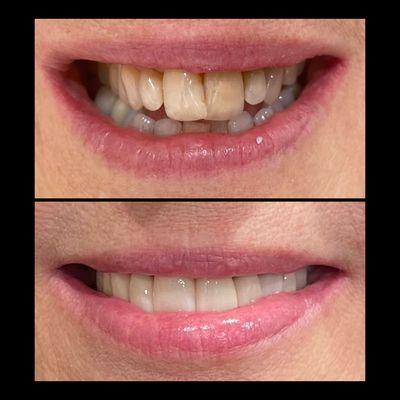 A beautiful transformation courtesy of Dr K.