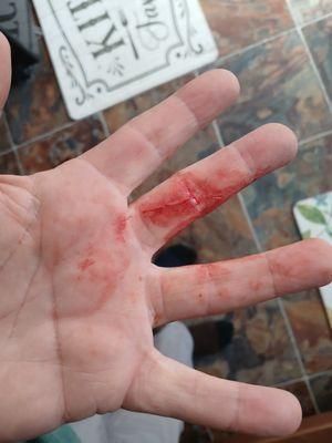 Negligence caused my injury