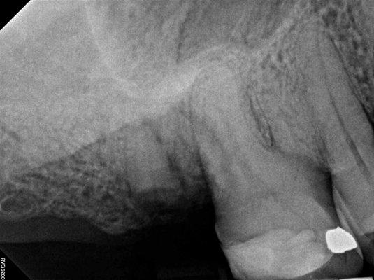 Jason Mirabile, DDS - iHateTheDentist.com