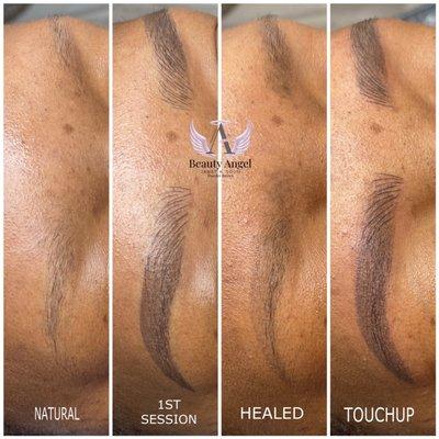 Before, after, healed and touchup for Microshading Combo.