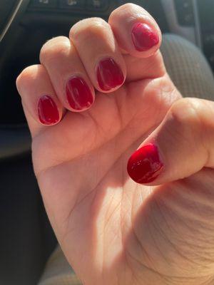 Two chipped on this hand