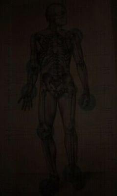 Fontenot T James, MD