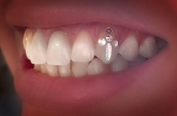 5 piece Swarovski Dagger Tooth Gem Design