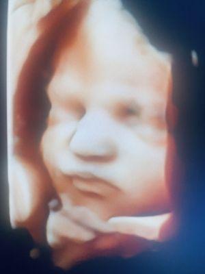 First Impressions 3D