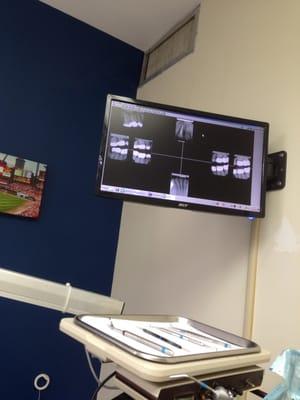 Digital X-rays too!!