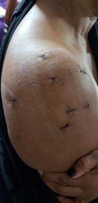 Orthopaedic Specialists of North County