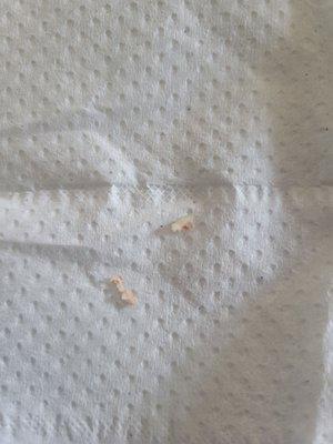 Tooth fragments pulled from gums that Dr. Hall said wasn't there.