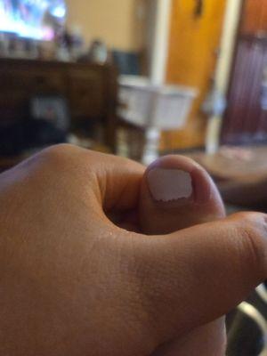 My toe after the puss came out and the green went away.