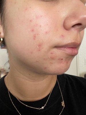 Avant Esthetic Skin Solutions