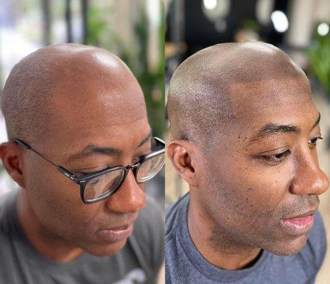 Scalp micro pigmentation mixer 12 /14