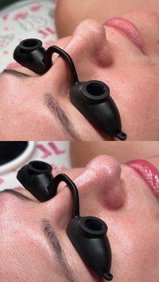 Top is before. Bottom is after