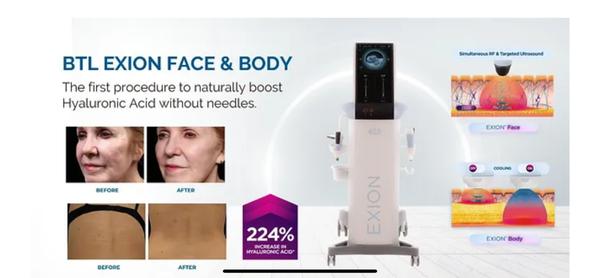 BTl Exion Body, Face, Micro Needle, Emfem 360