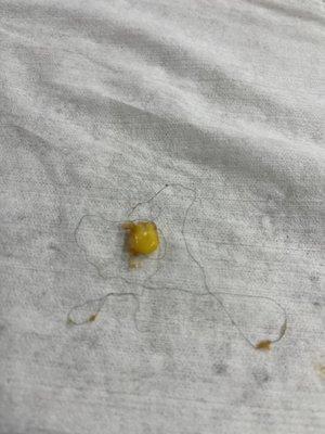 Hair in the BBQ mashed potato bowl