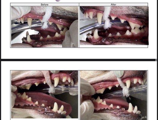Teeth Cleaning Procedure