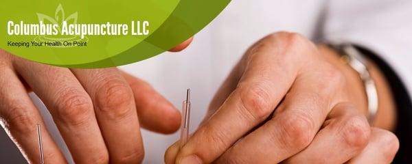 Columbus Acupuncture