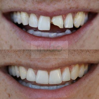 TruGlo Modern Dental