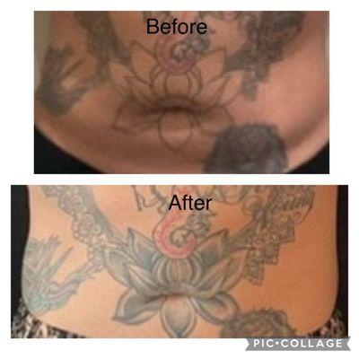 After two one hour treatments