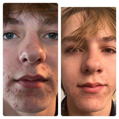 One week after seeing Taylor Todd at Clarity on Pine Bluff in Parker