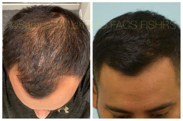 Lam Facial Plastics