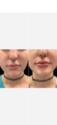Advancedmd Aesthetics of Atlanta