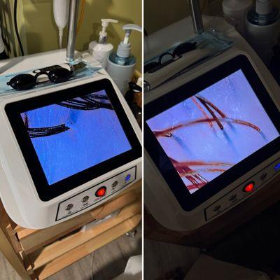 Before on left. After on right