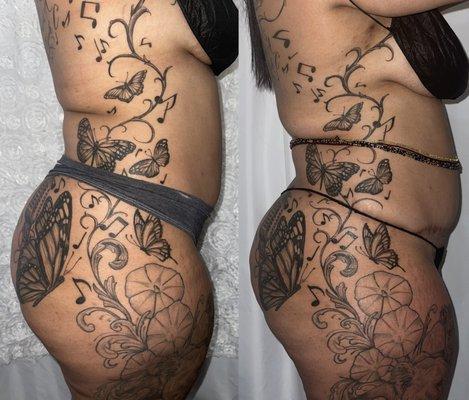 Before and after pictures of stomach "right to left"