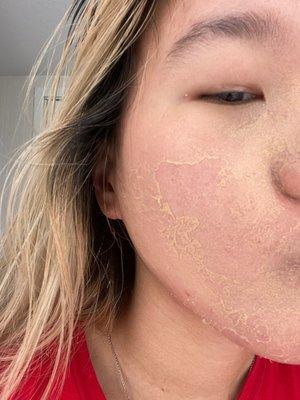 Los Angeles Skin Care